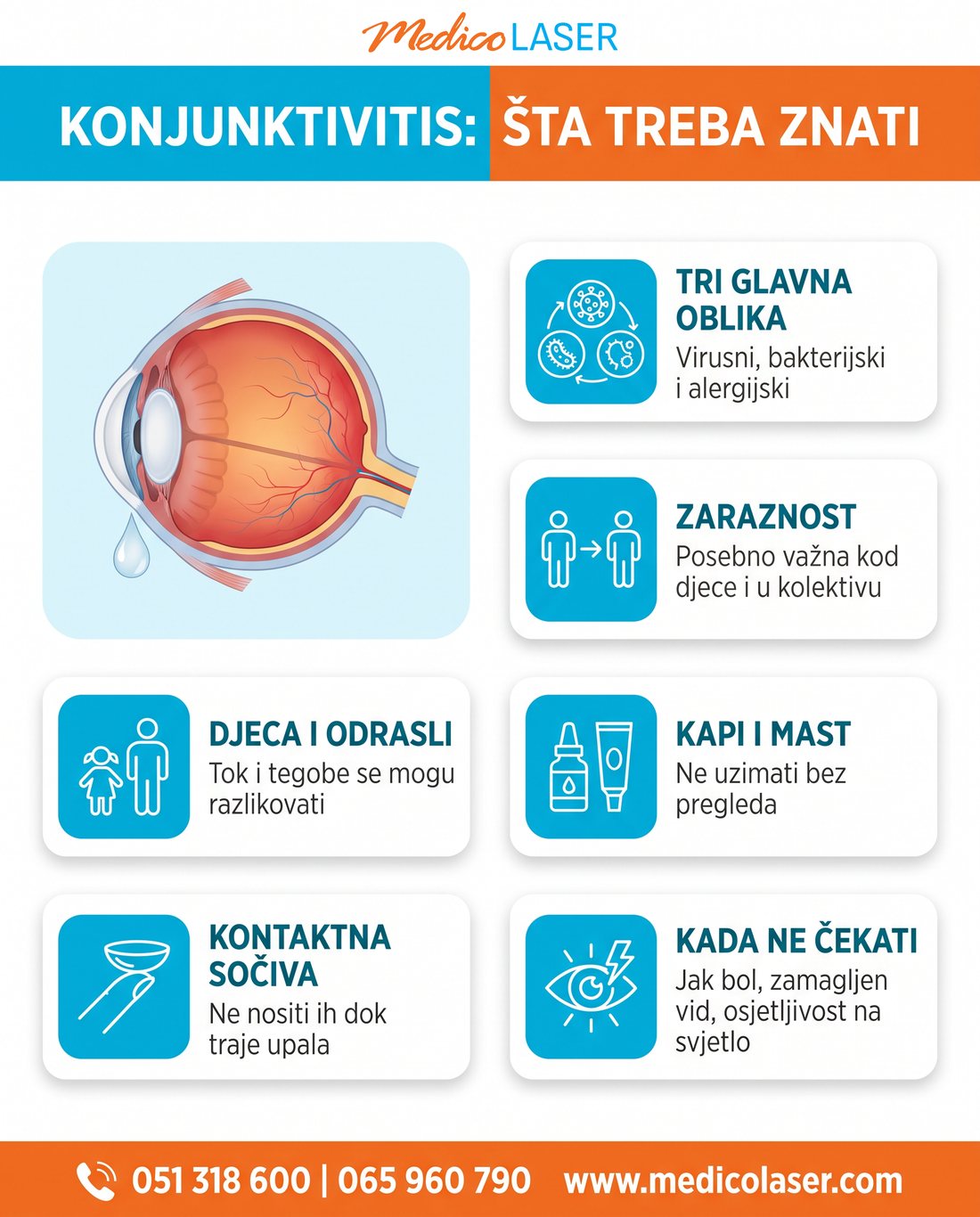 Šest činjenica o konjunktivitisu: tri glavna oblika, zaraznost, djeca i odrasli, kapi i mast, kontaktna sočiva i kada ne čekati