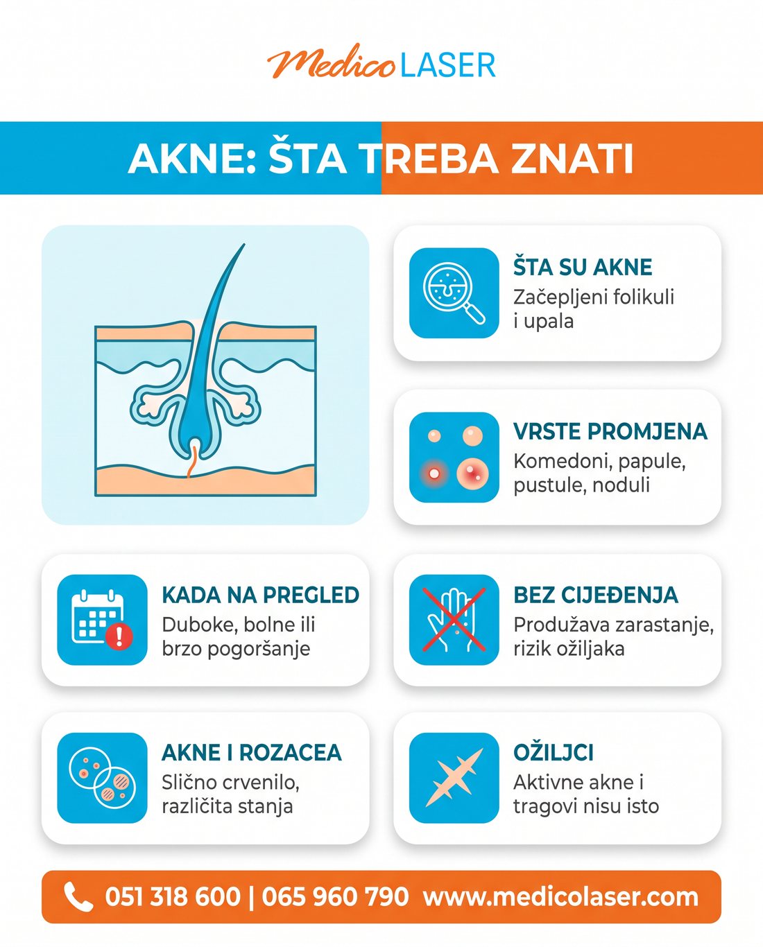 Šest činjenica o aknama: šta su akne, vrste promjena, kada na pregled, zašto ne cijediti, razlika od rozacee i ožiljci