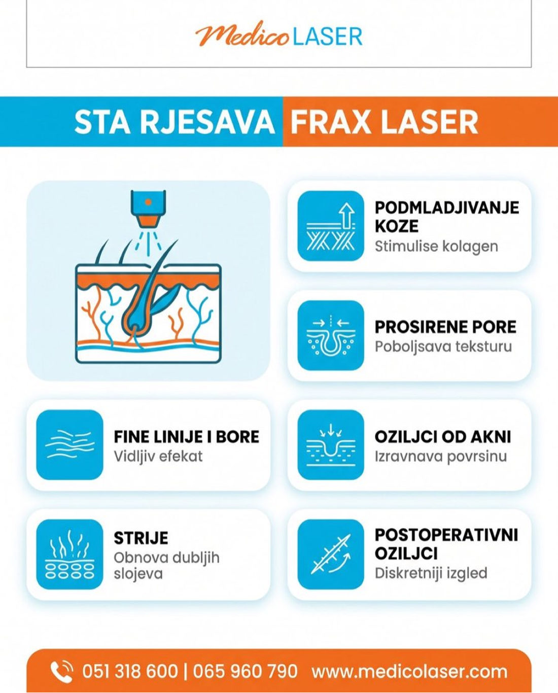 Sta rjesava FRAX 1550 laser - infografika