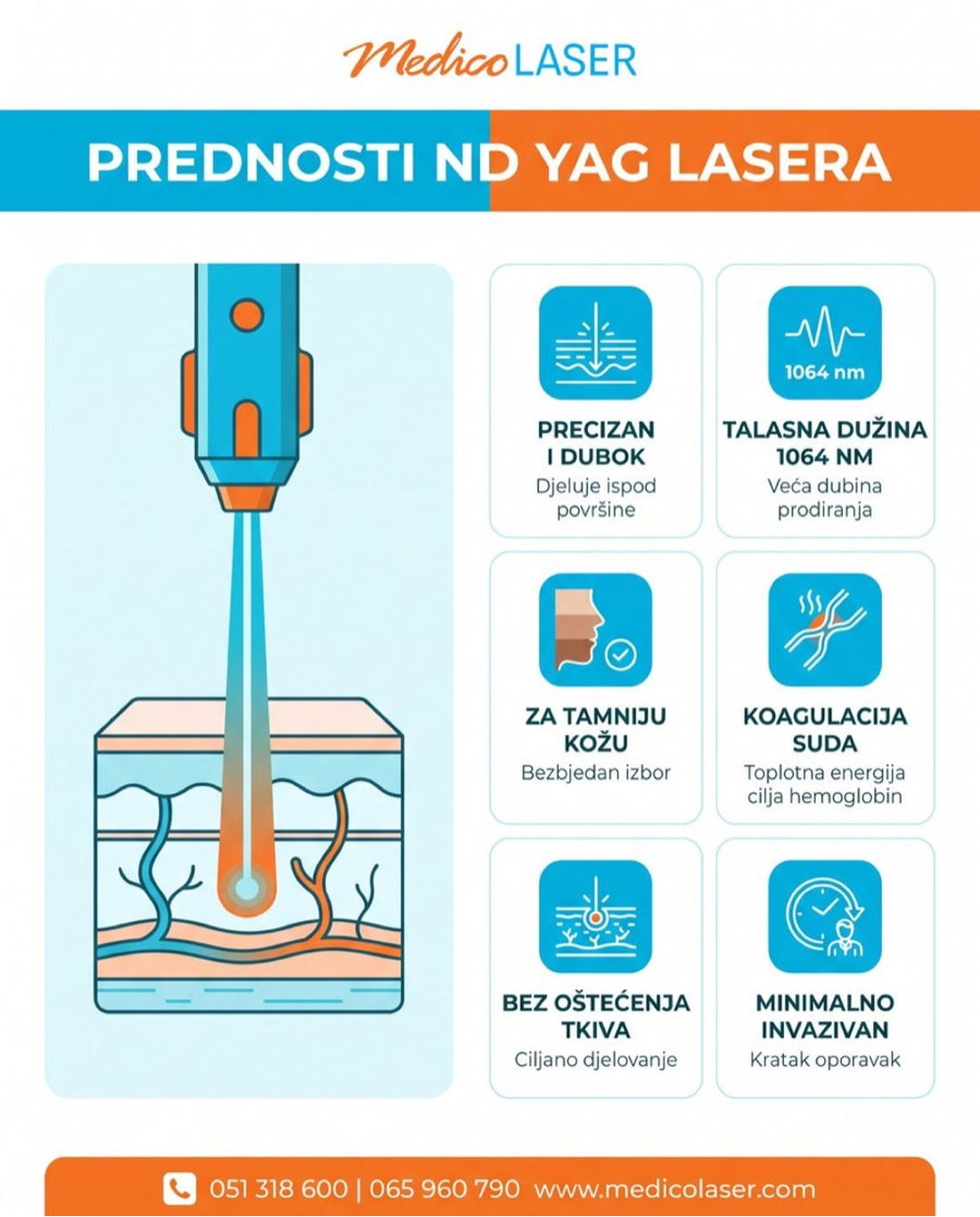 Prednosti Nd YAG lasera - infografika