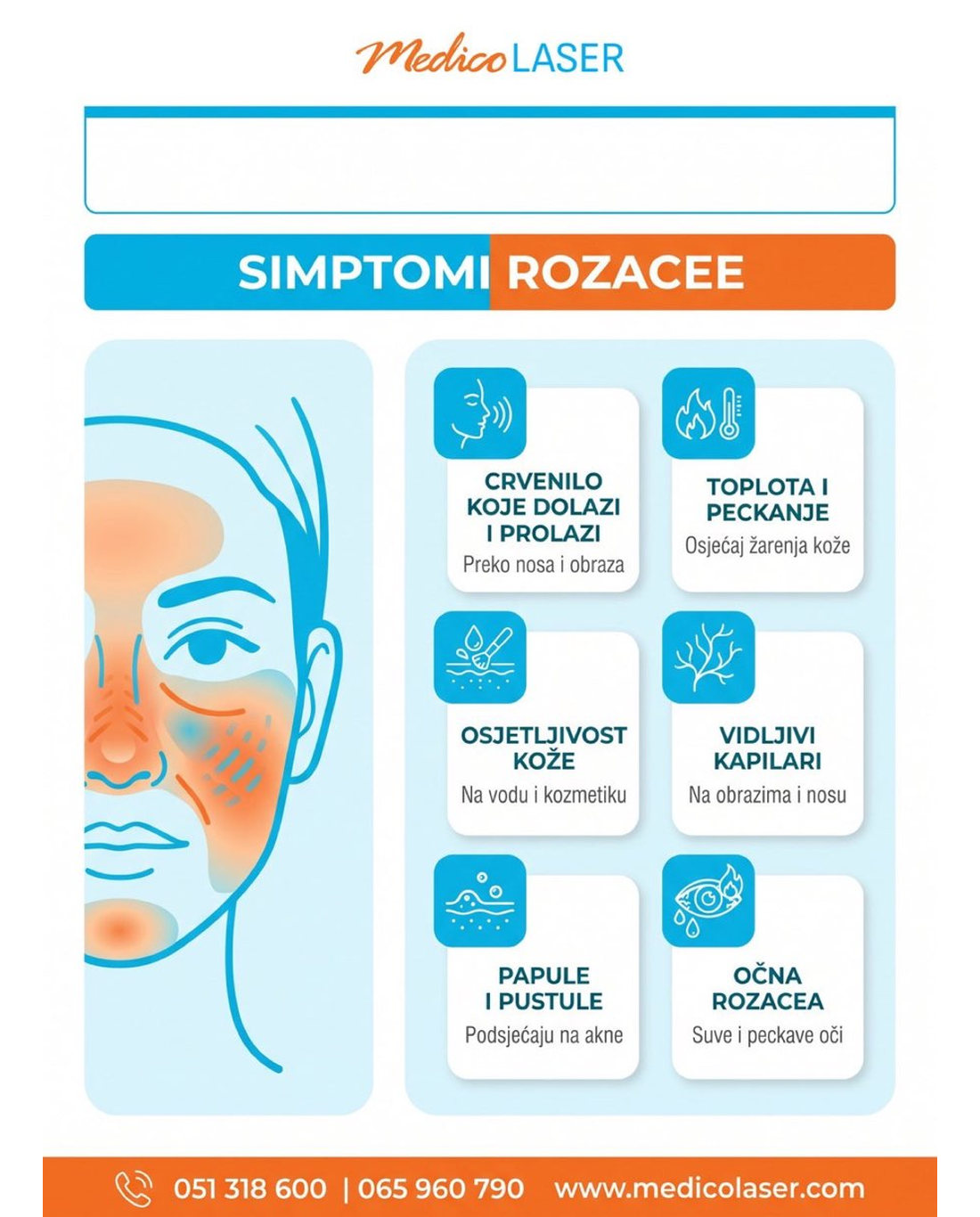Simptomi rozacee - infografika
