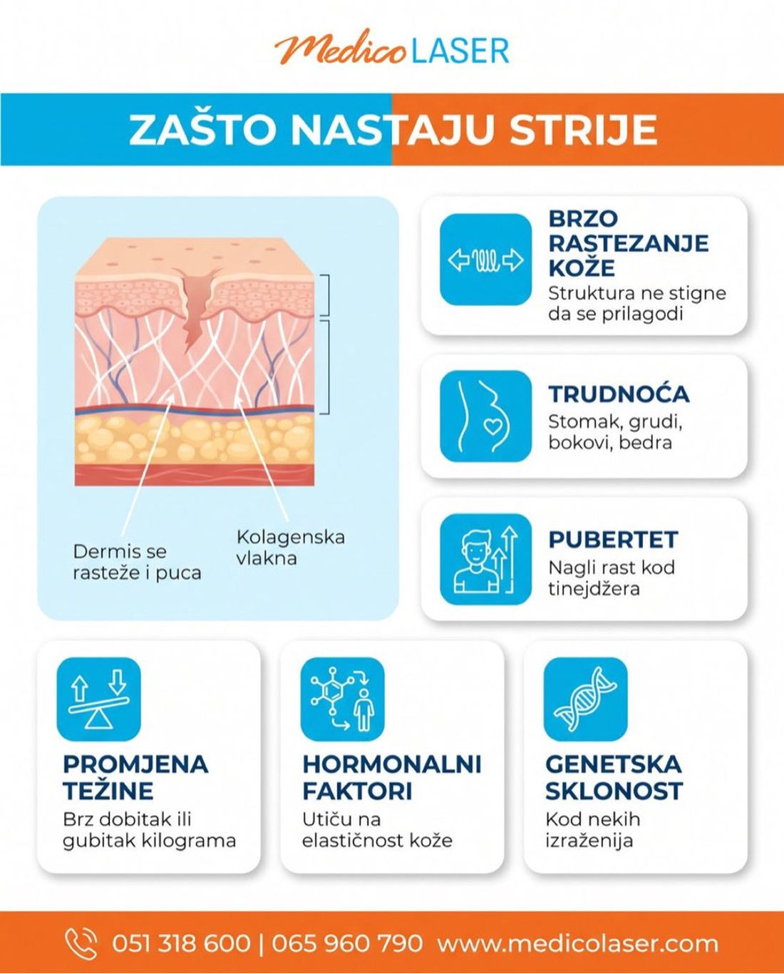 Zašto nastaju strije - uzroci