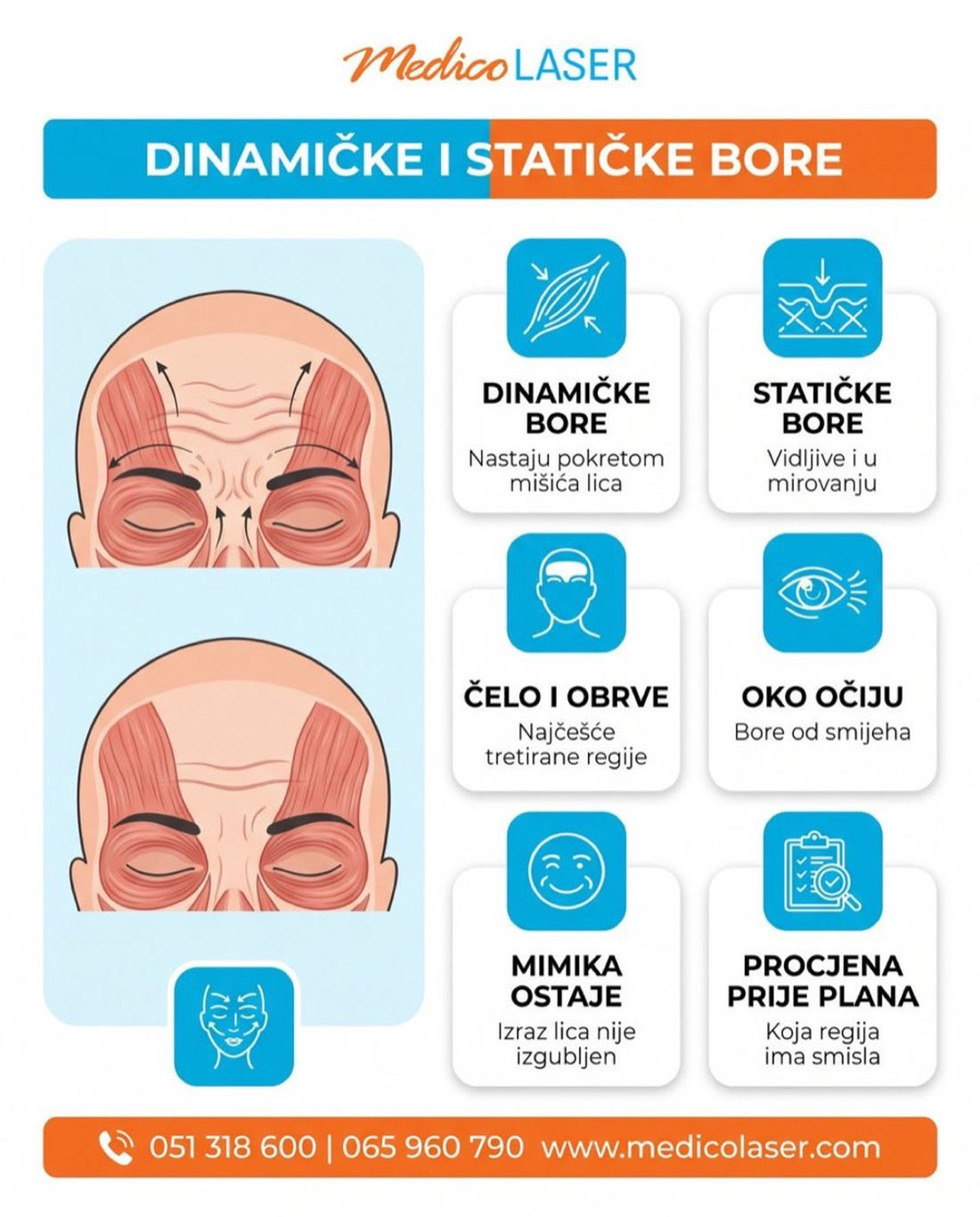 Dinamičke i statičke bore lica - razlika, najčešće tretirane regije čelo i oko očiju, mimika ostaje, procjena prije plana