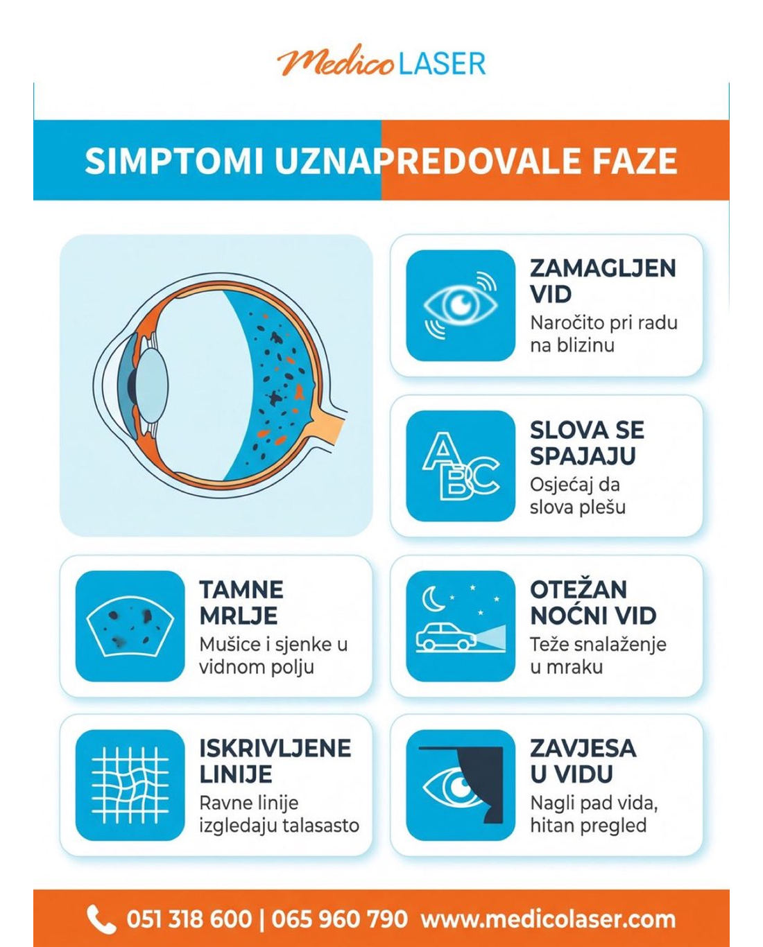 Simptomi uznapredovale dijabetičke retinopatije - zamagljen vid, slova se spajaju, tamne mrlje, otežan noćni vid