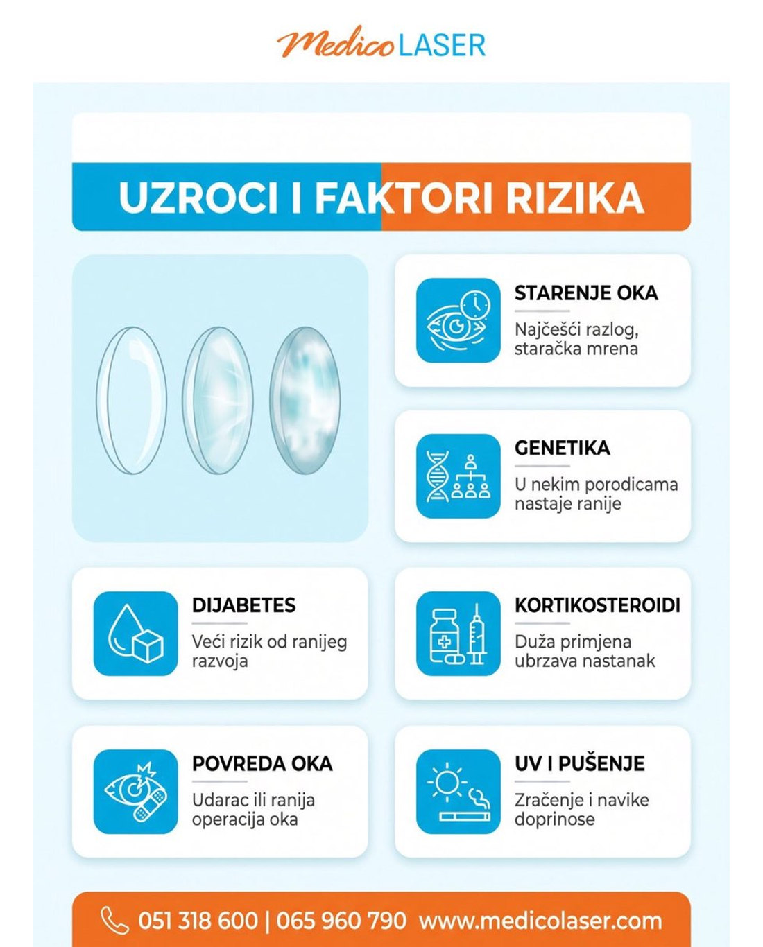 Uzroci i faktori rizika za kataraktu - infografika