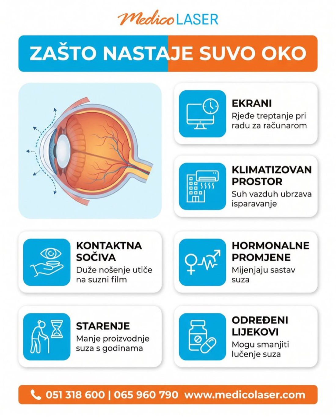 Zašto nastaje suvo oko - infografika uzroka: ekrani, klimatizovan prostor, kontaktna sočiva, hormoni, starenje, lijekovi