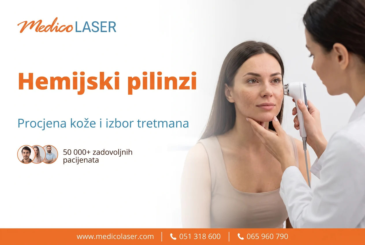 Hemijski pilinzi