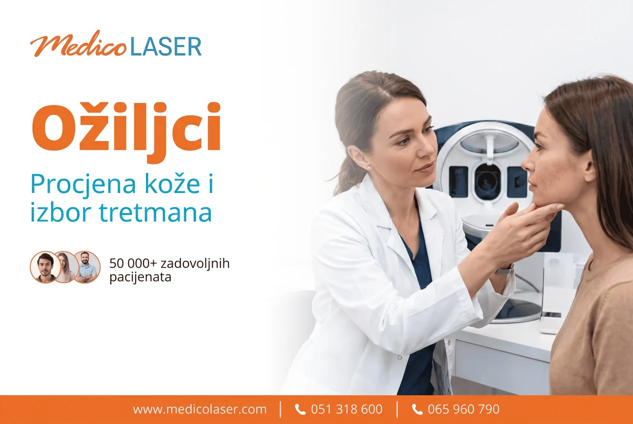 Ožiljci