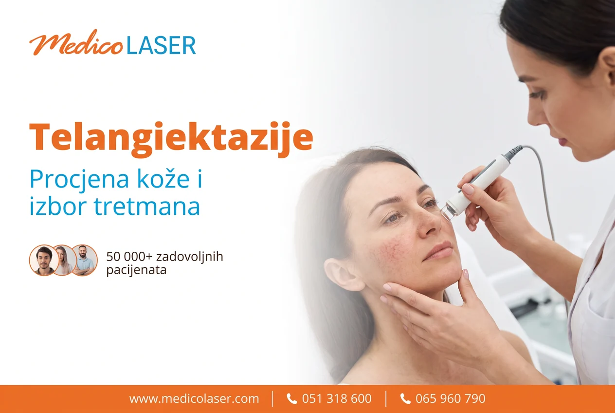 Telangiektazije