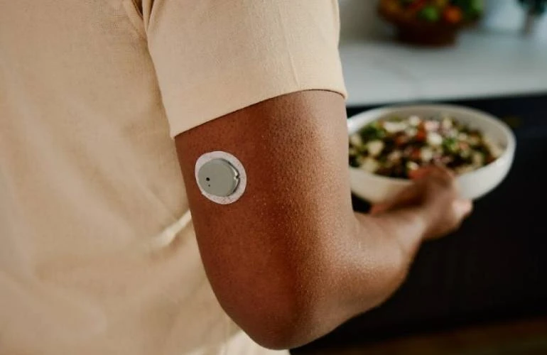 Kontinuierlicher Glukosesensor an der Rückseite des Oberarms