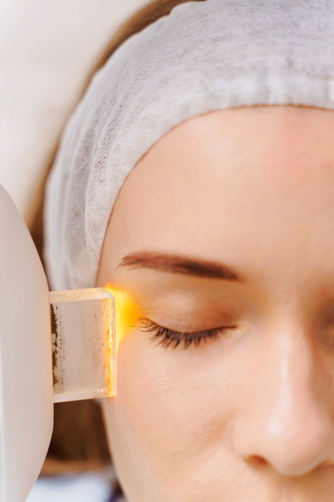 BBL Photofacial treatment at Nashville Skin Company in Nashville, TN