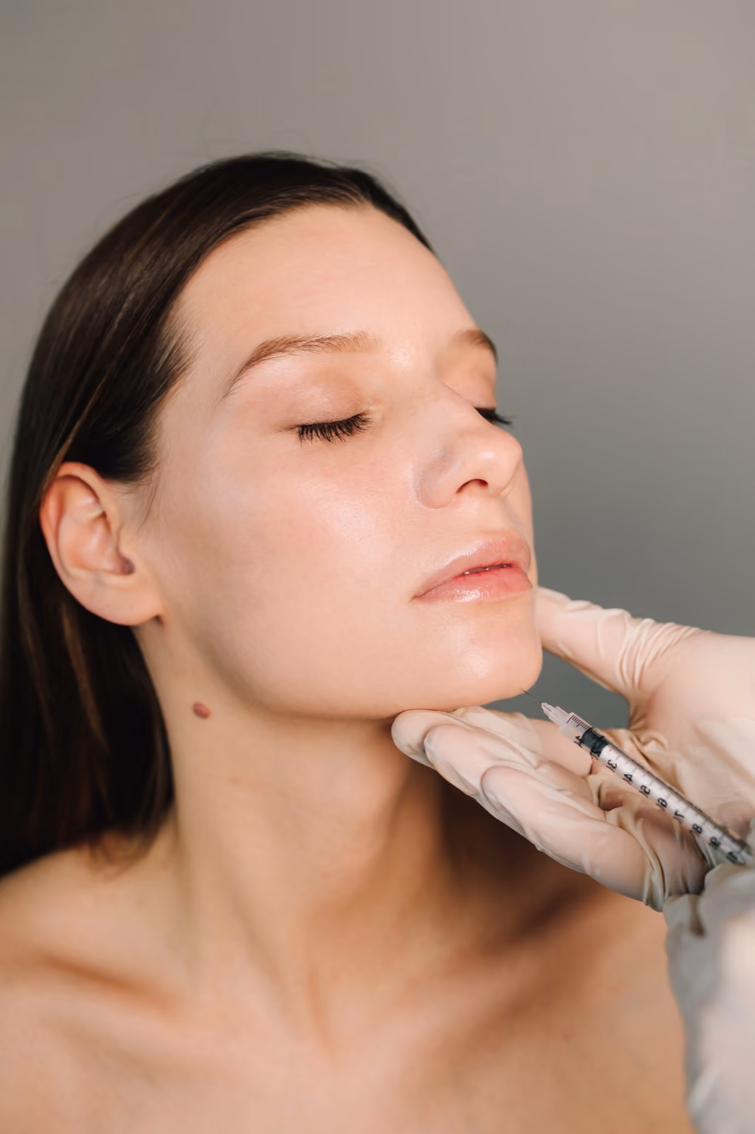 Collagen Biostimulators (Radiesse) treatment at Nashville Skin Company in Nashville, TN