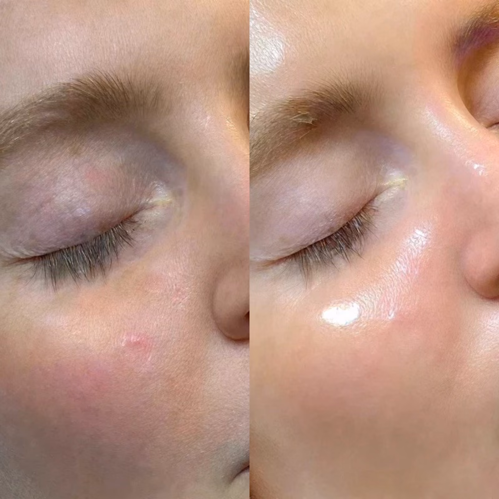 Facial treatment at Nashville Skin Company in Nashville, TN