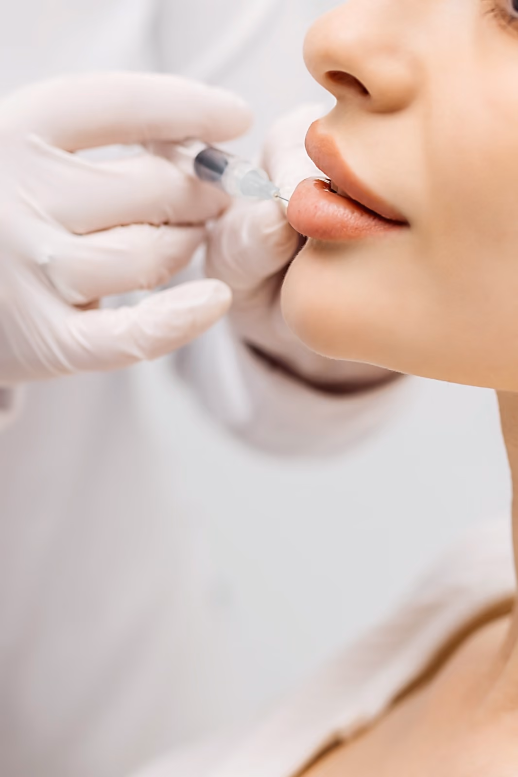 Dermal and lip filler treatment at Nashville Skin Company in Nashville, TN