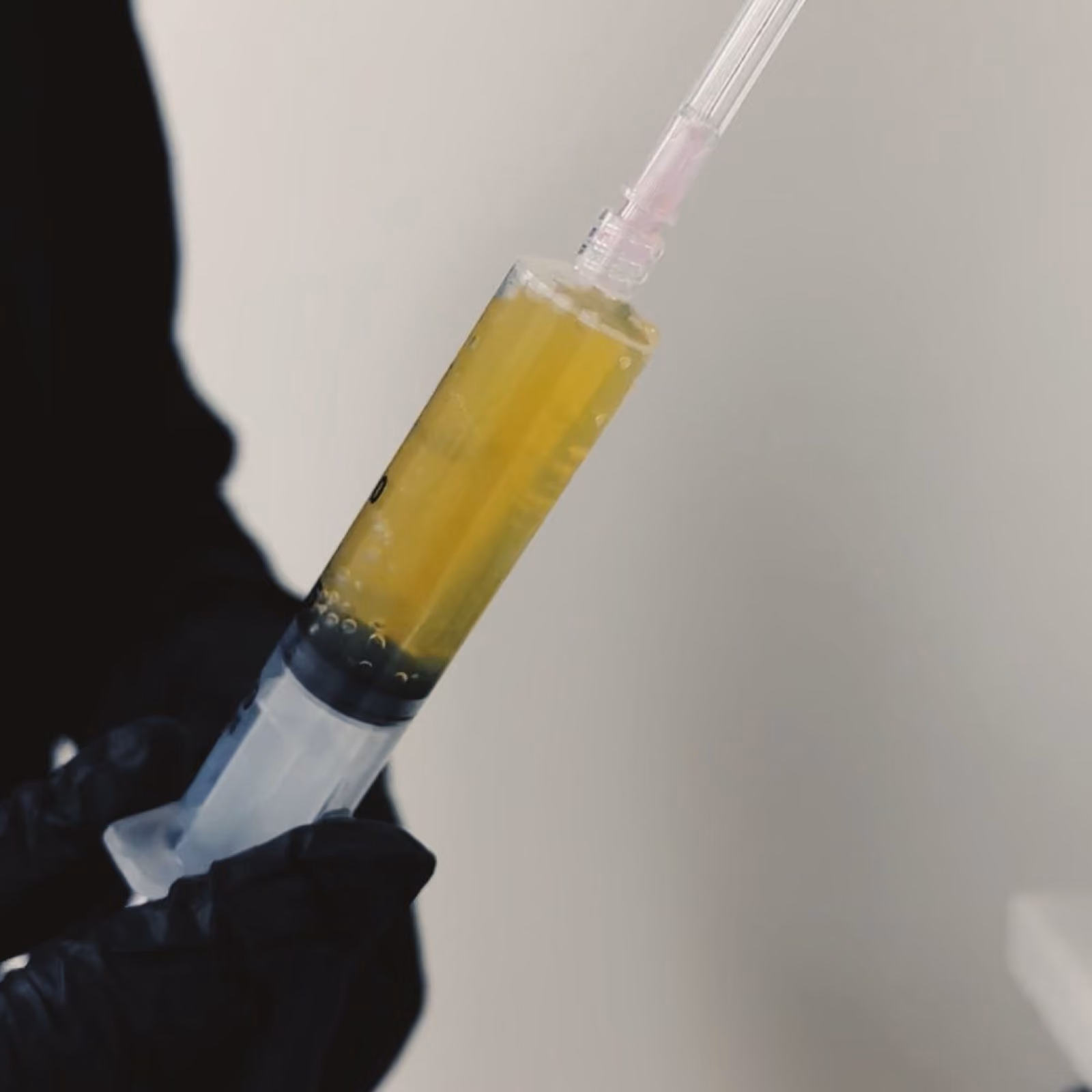 PRP platelet-rich plasma at Nashville Skin Company in Nashville, TN
