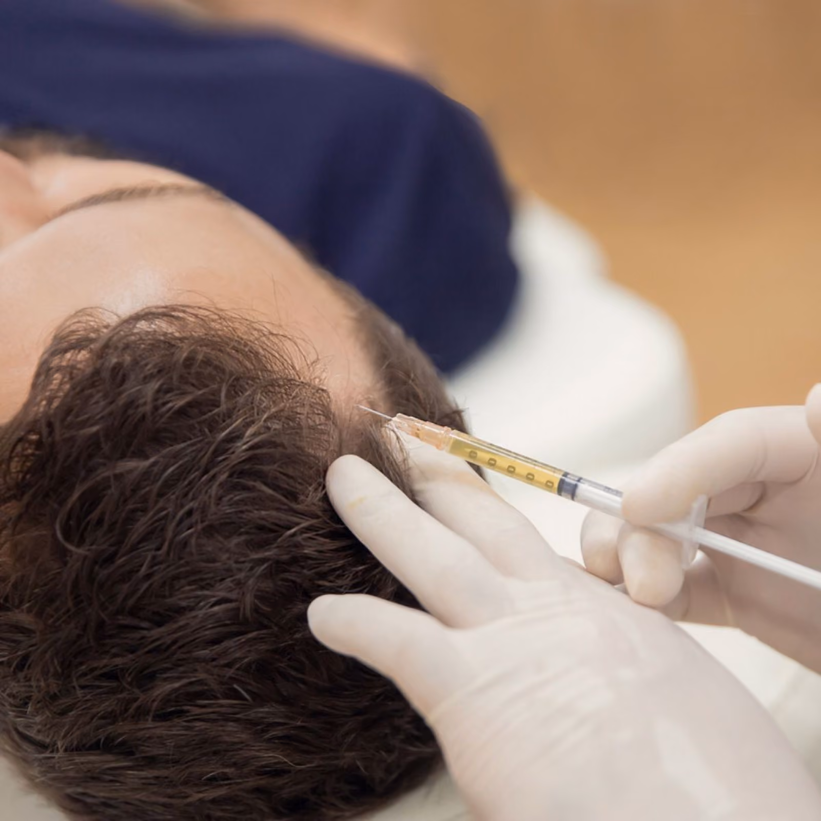 PRP platelet-rich plasma at Nashville Skin Company in Nashville, TN