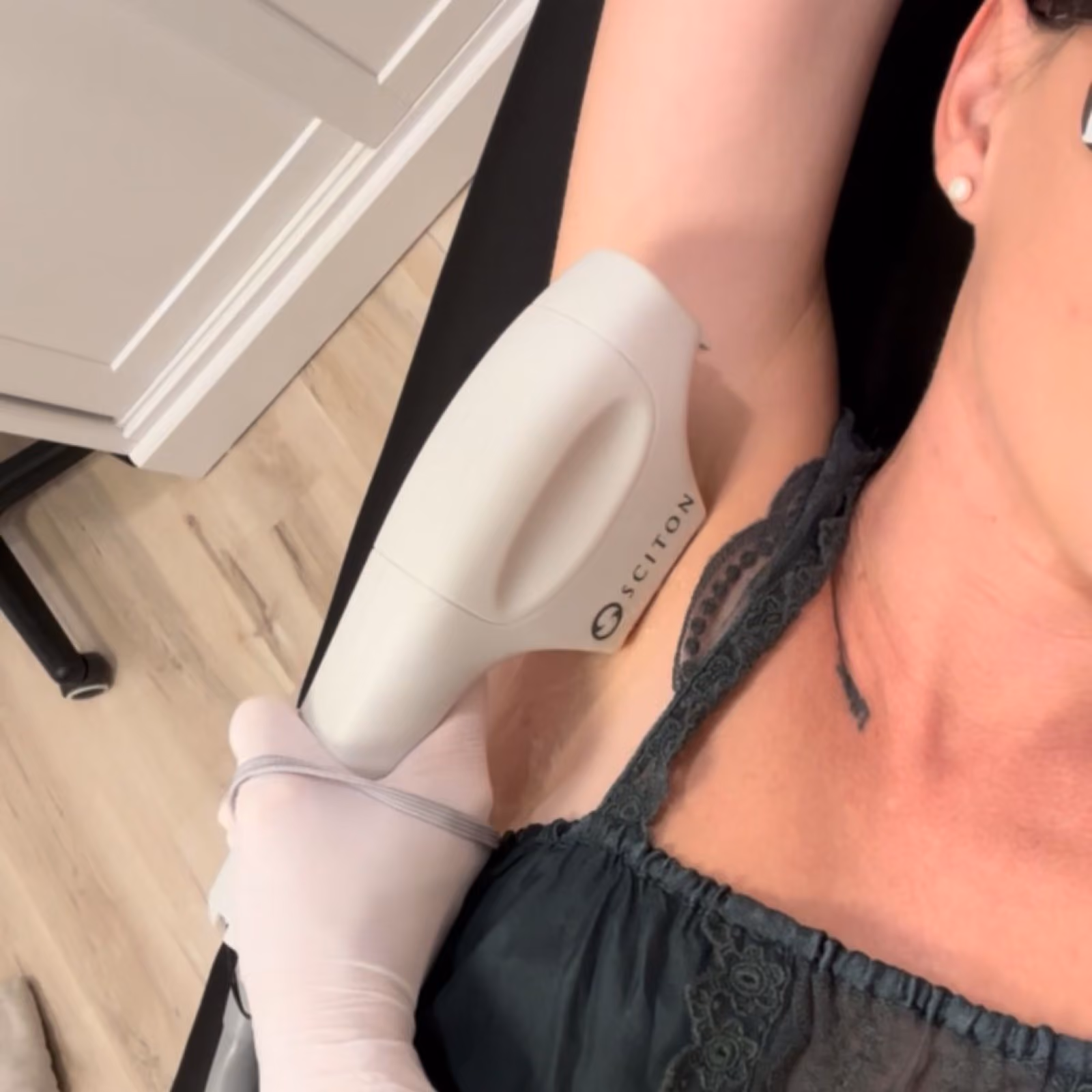 Laser hair removal at Nashville Skin Company in Nashville, TN