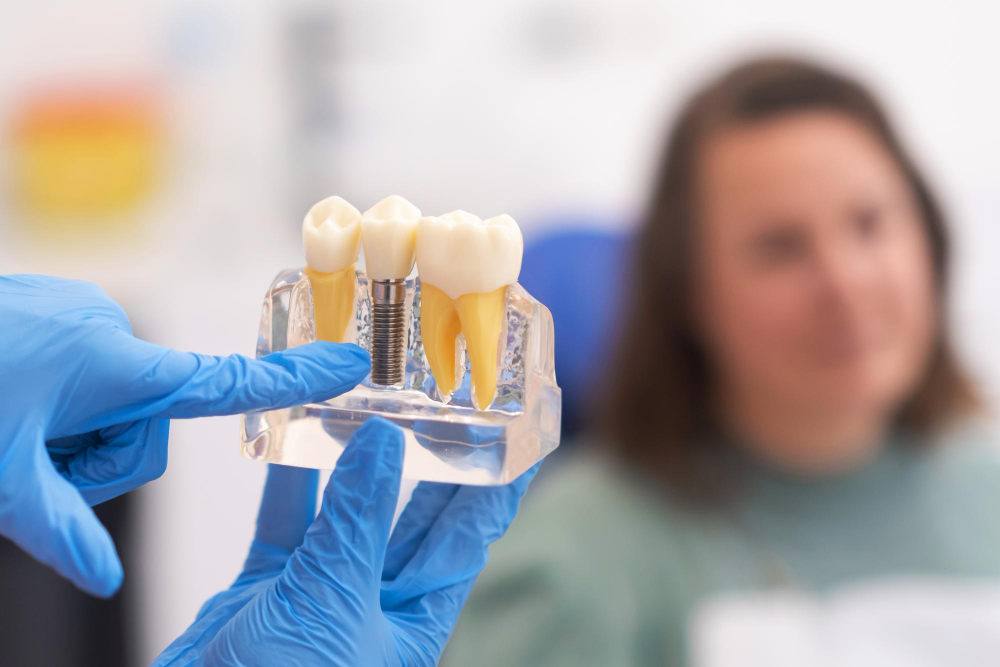 Dental model showing a natural tooth, dental implant, and crown held by gloved hands in a clinic.