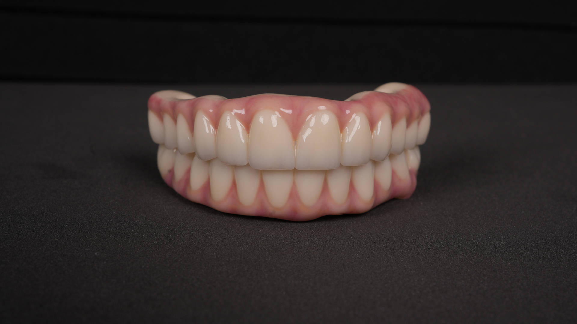 full mouth all on 4 set of teeth