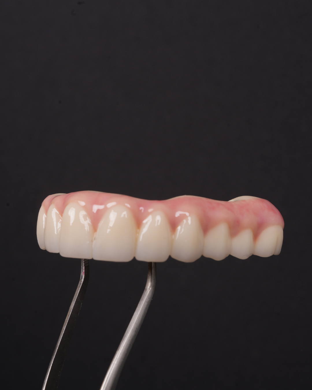 single arch all on 4 teeth