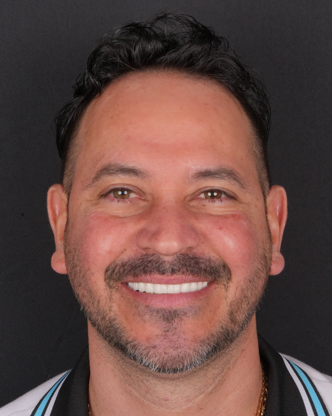 Patient testimonial Orestes S