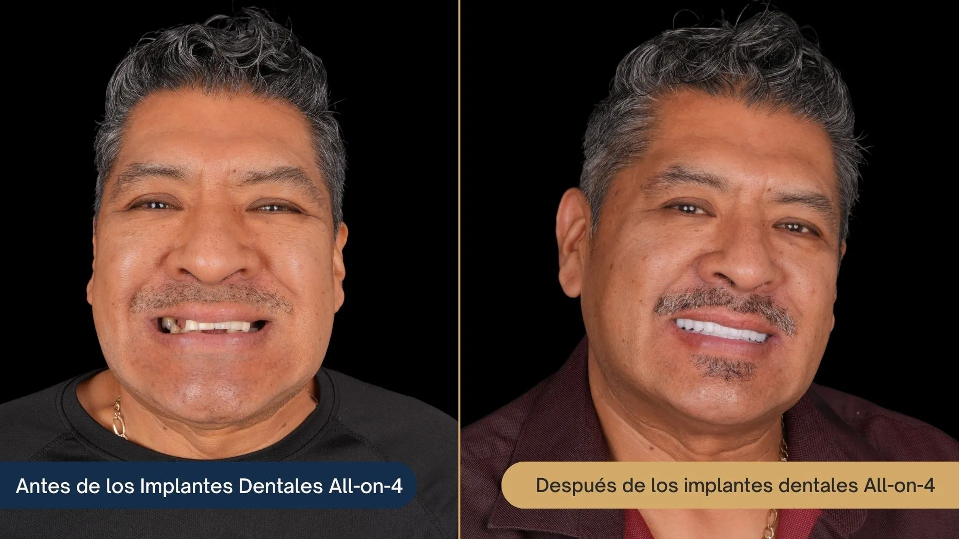 Patient transformation