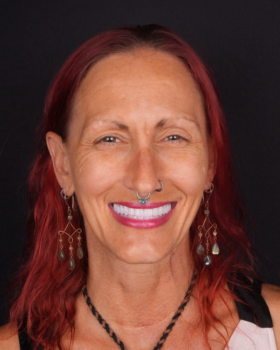 Patient testimonial Julie P