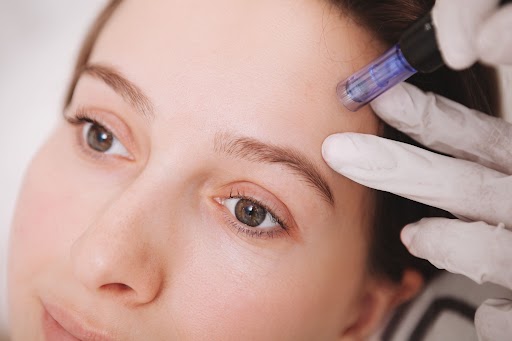 AQUAGOLD® vs Traditional Microneedling: Which Treatment Is Better for Smoother Skin?