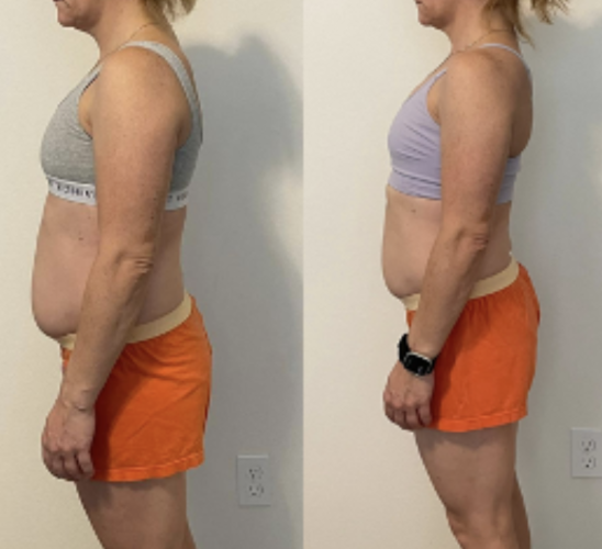 Before and after image 