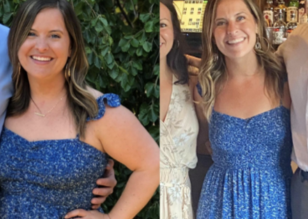 Before and after image 