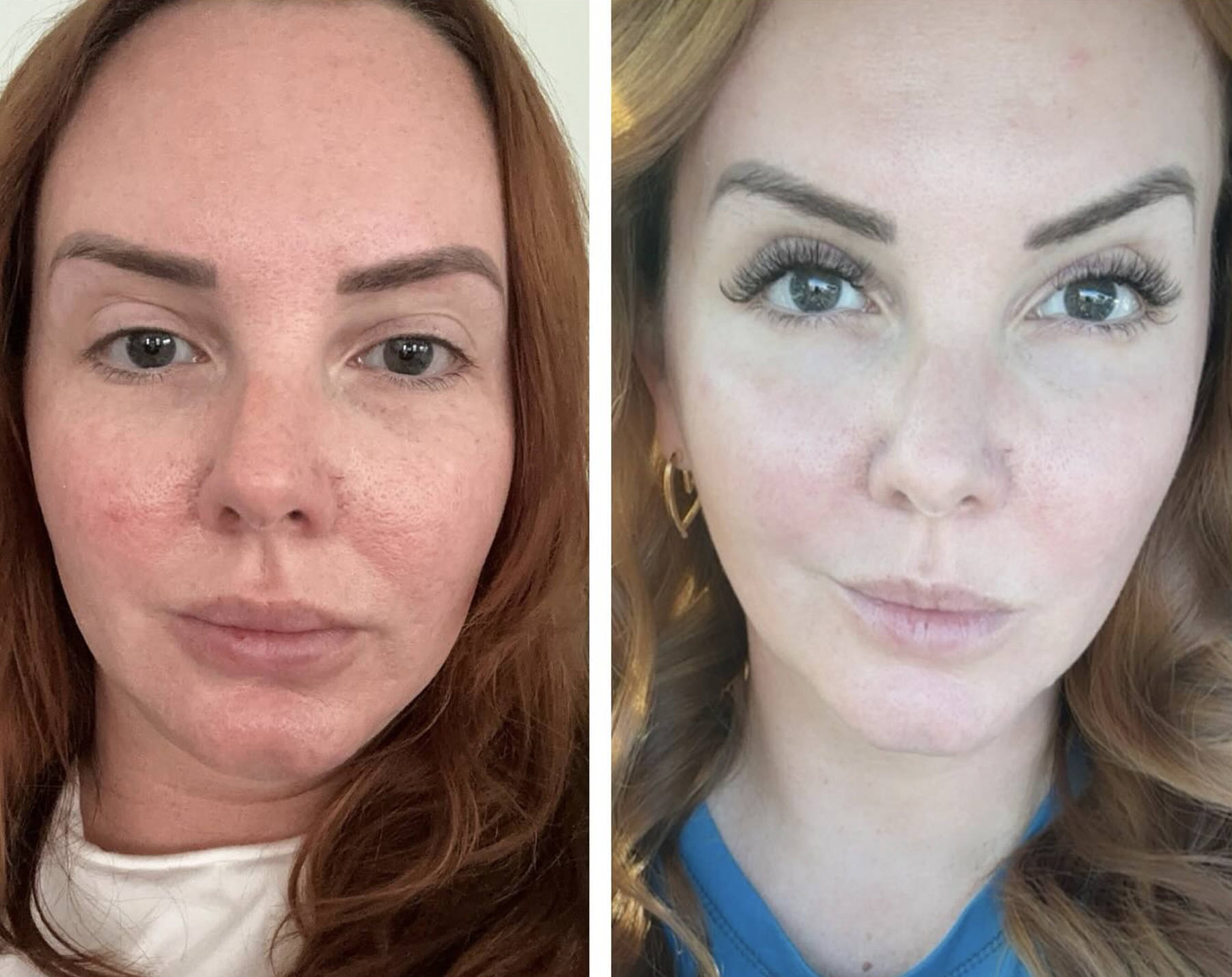 Before and after image 