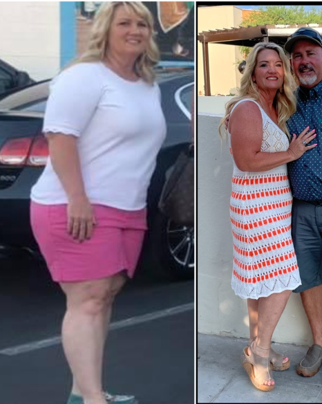 Before and after image 