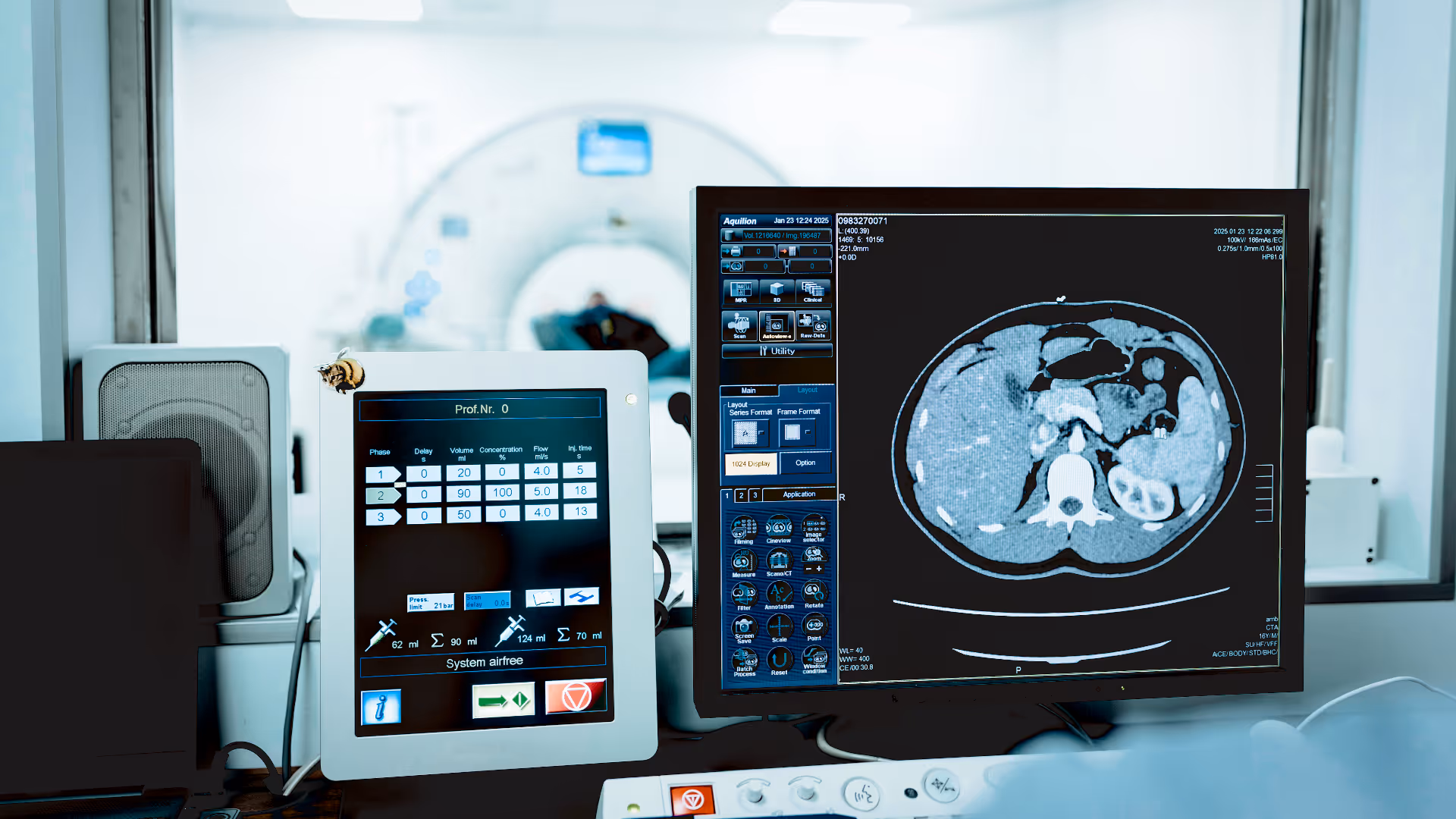 chest ct scan