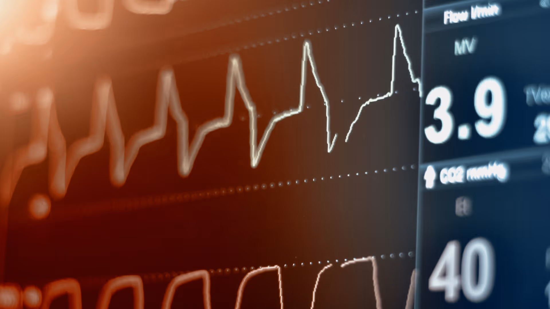 Screen of a heart monitor