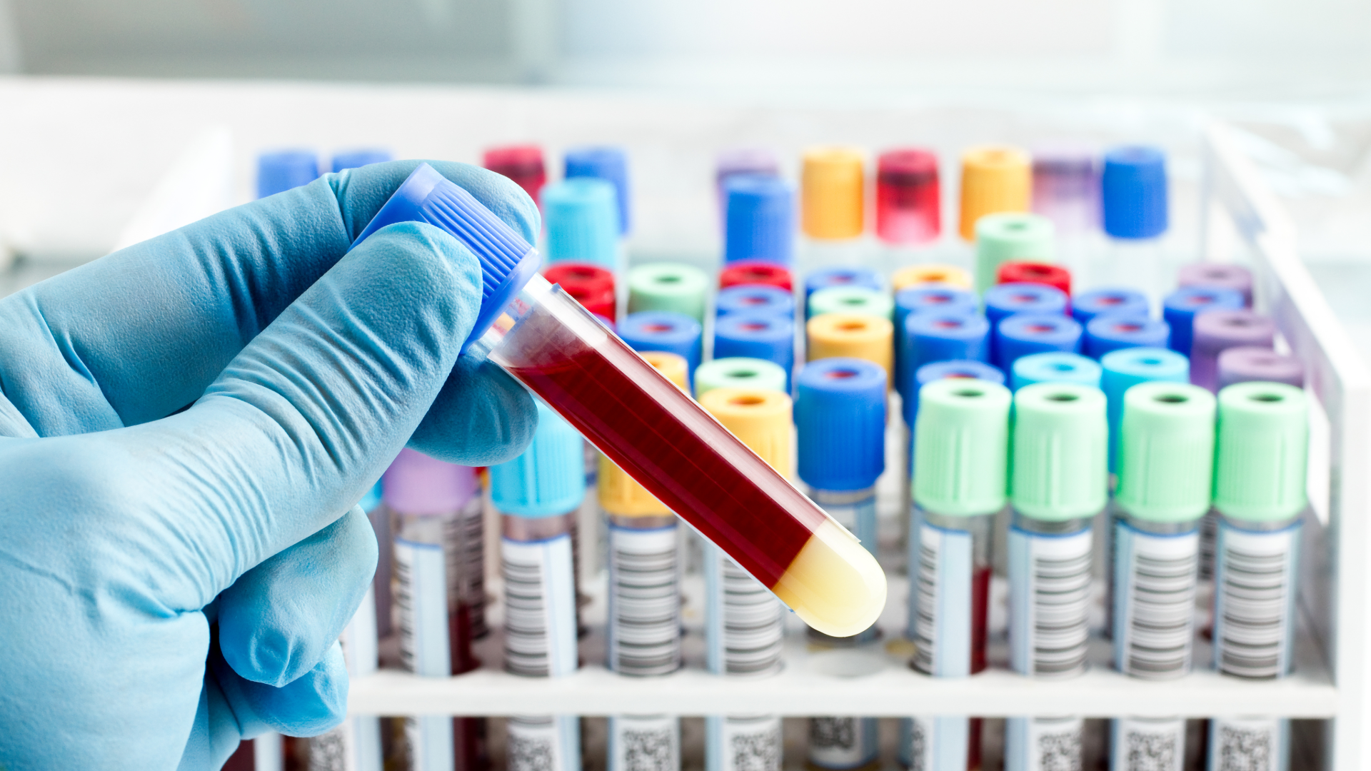 Lab work test vials