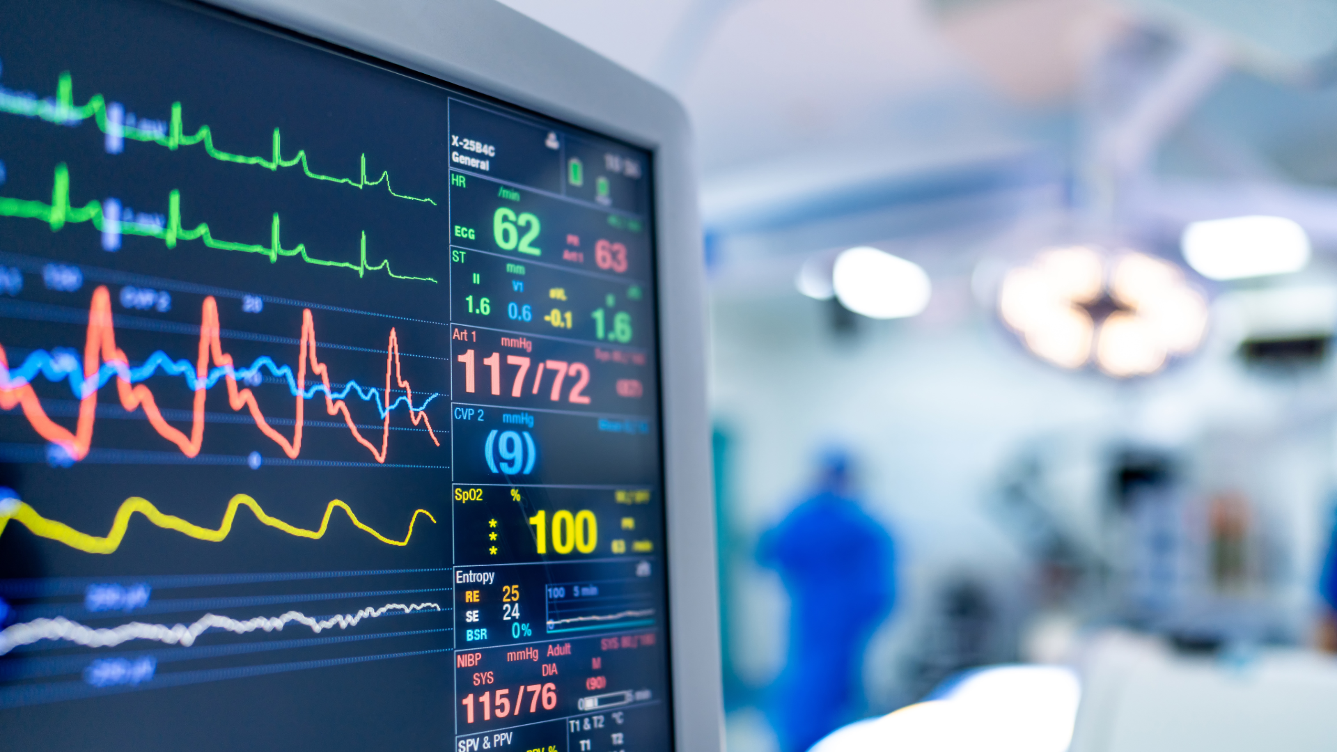 Monitor showing patient vitals in operating room