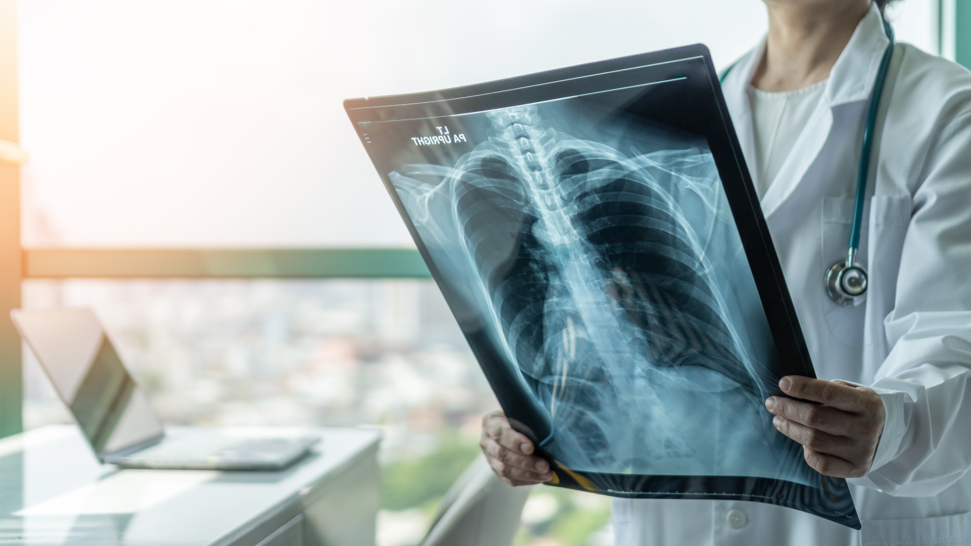 Physician reviewing chest xray