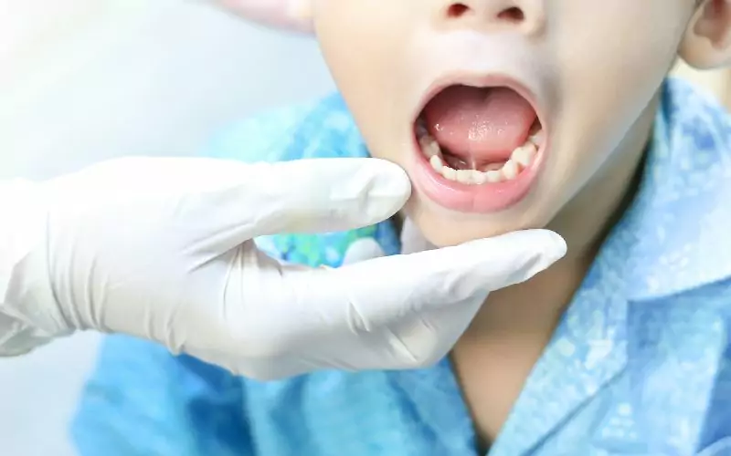 Dentist gently examining a child’s tongue mobility during a dental visit