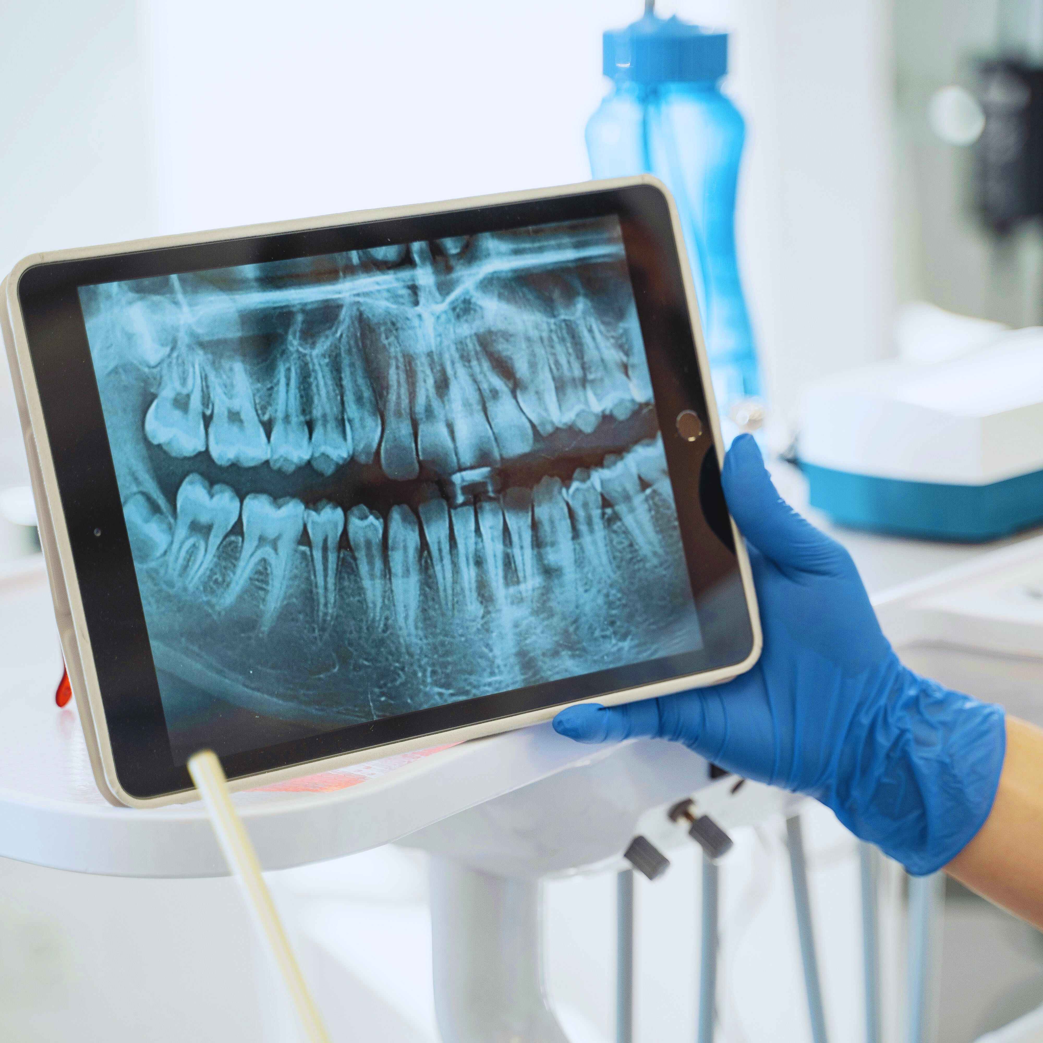 Person holding up an X ray of teeth