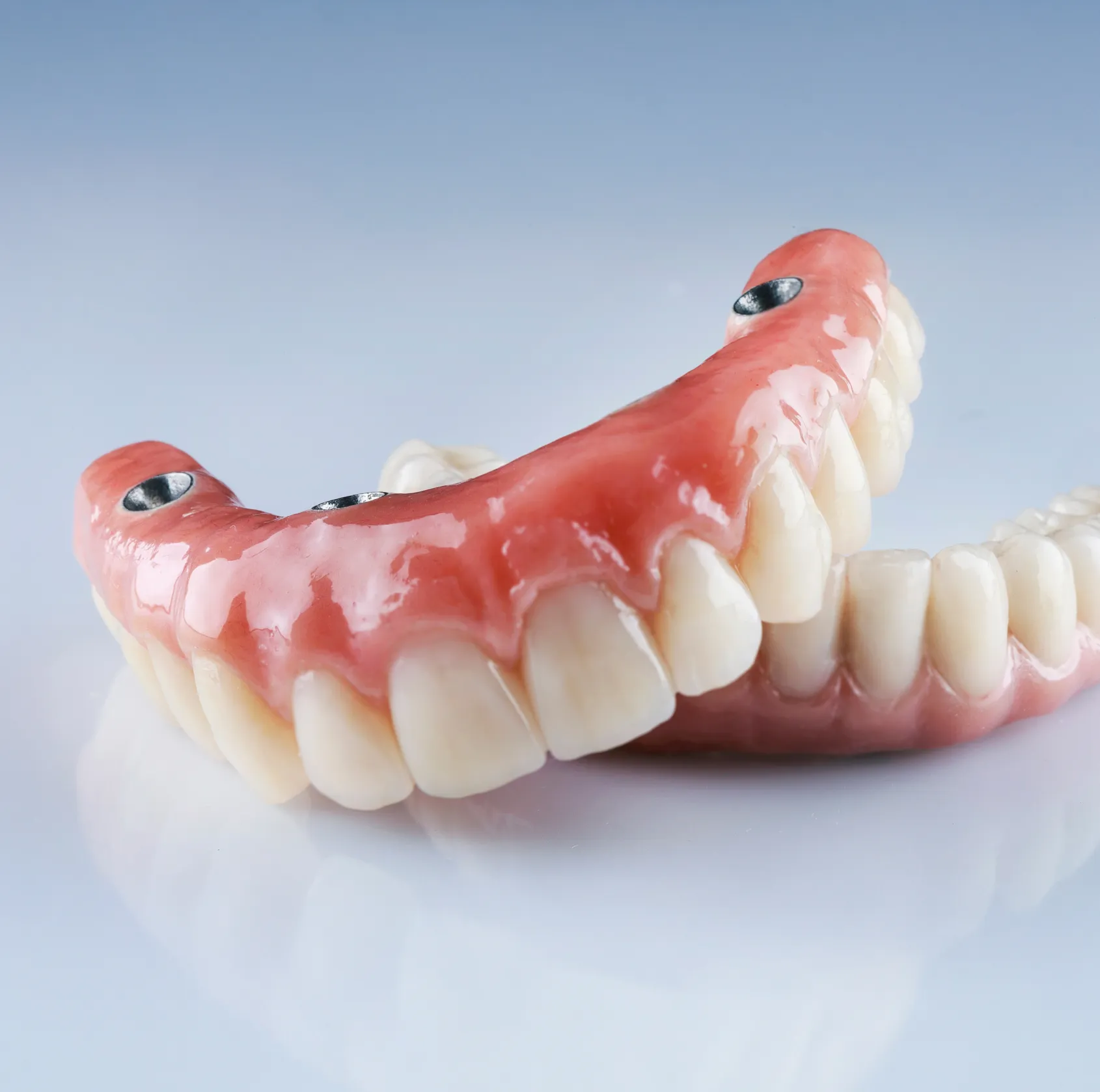 Monarch Snap On denture