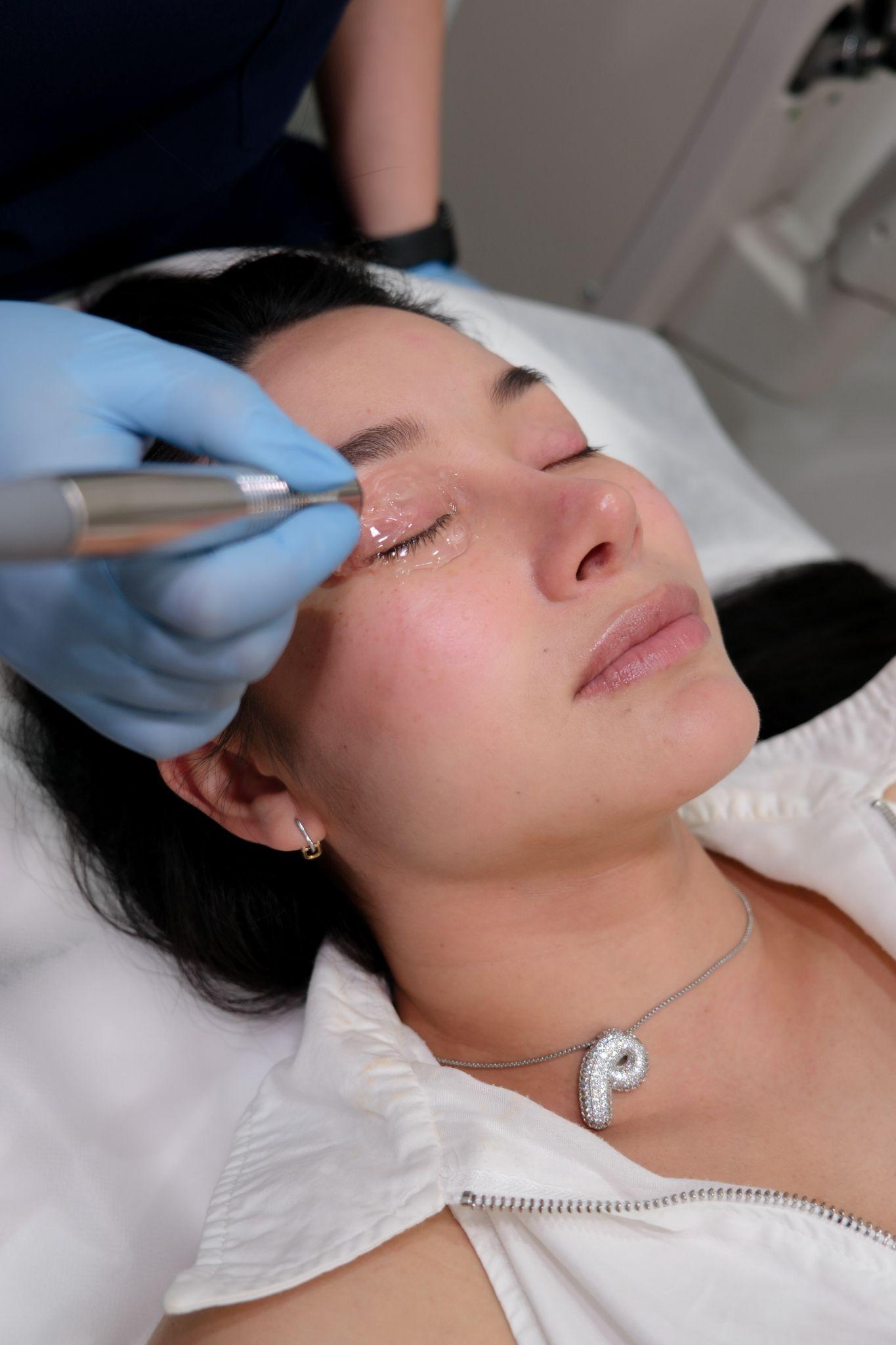 Dry eye evaluation at EyeC Optometry