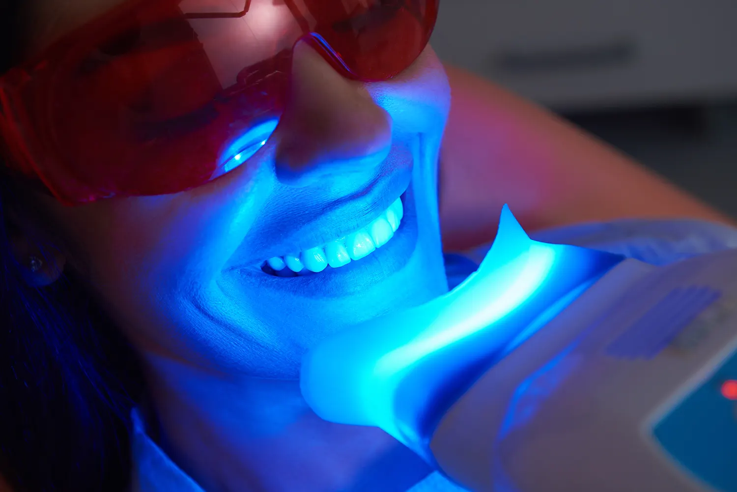 Professional Teeth Whitening