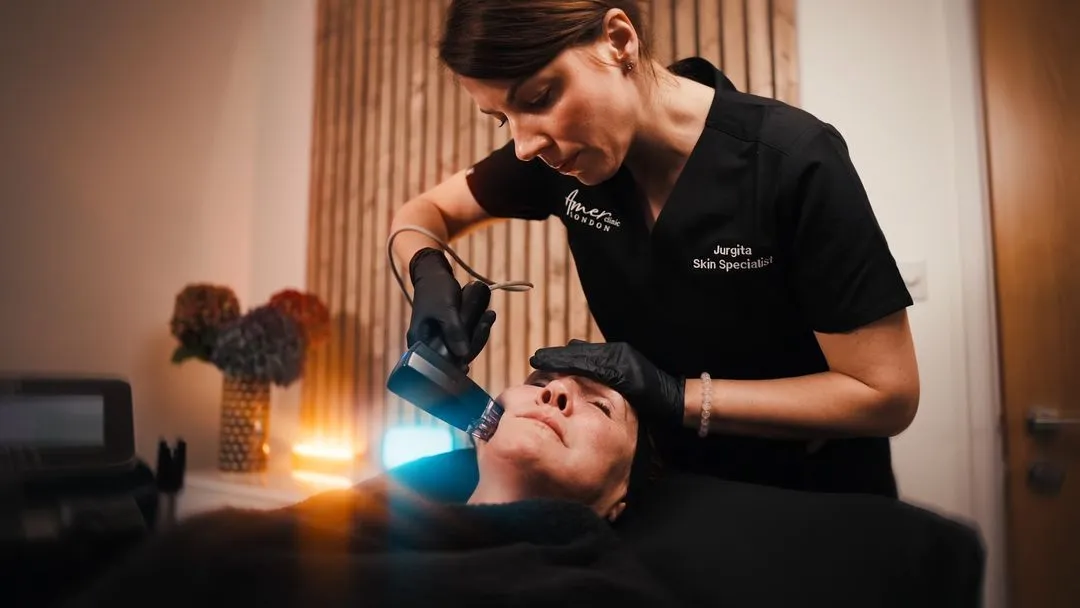 Morpheous 8 treatment
