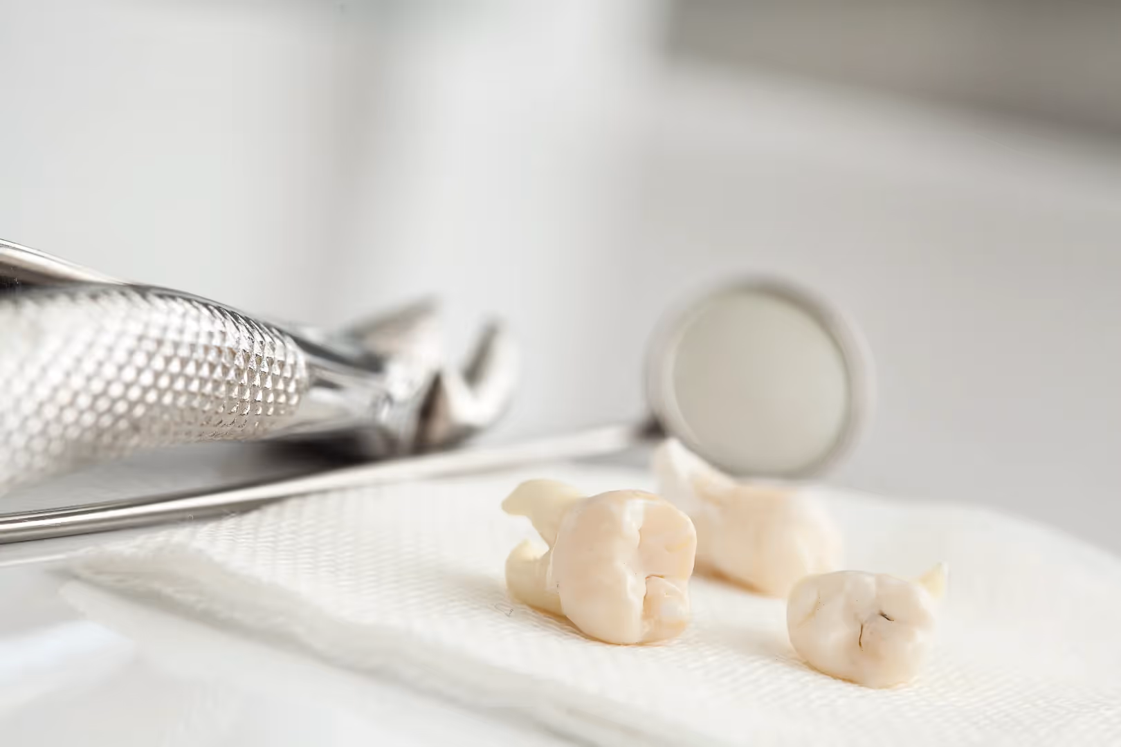 When Is the Best Time to Get Wisdom Teeth Removed?