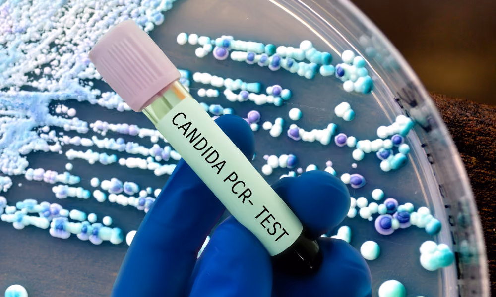 The Accidental Antifungals: Are Common Meds Quietly Treating Candida?