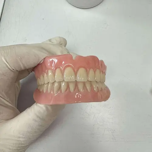 Complete set of full upper and lower dentures held by a gloved technician at Rayvetty Denture Clinic.