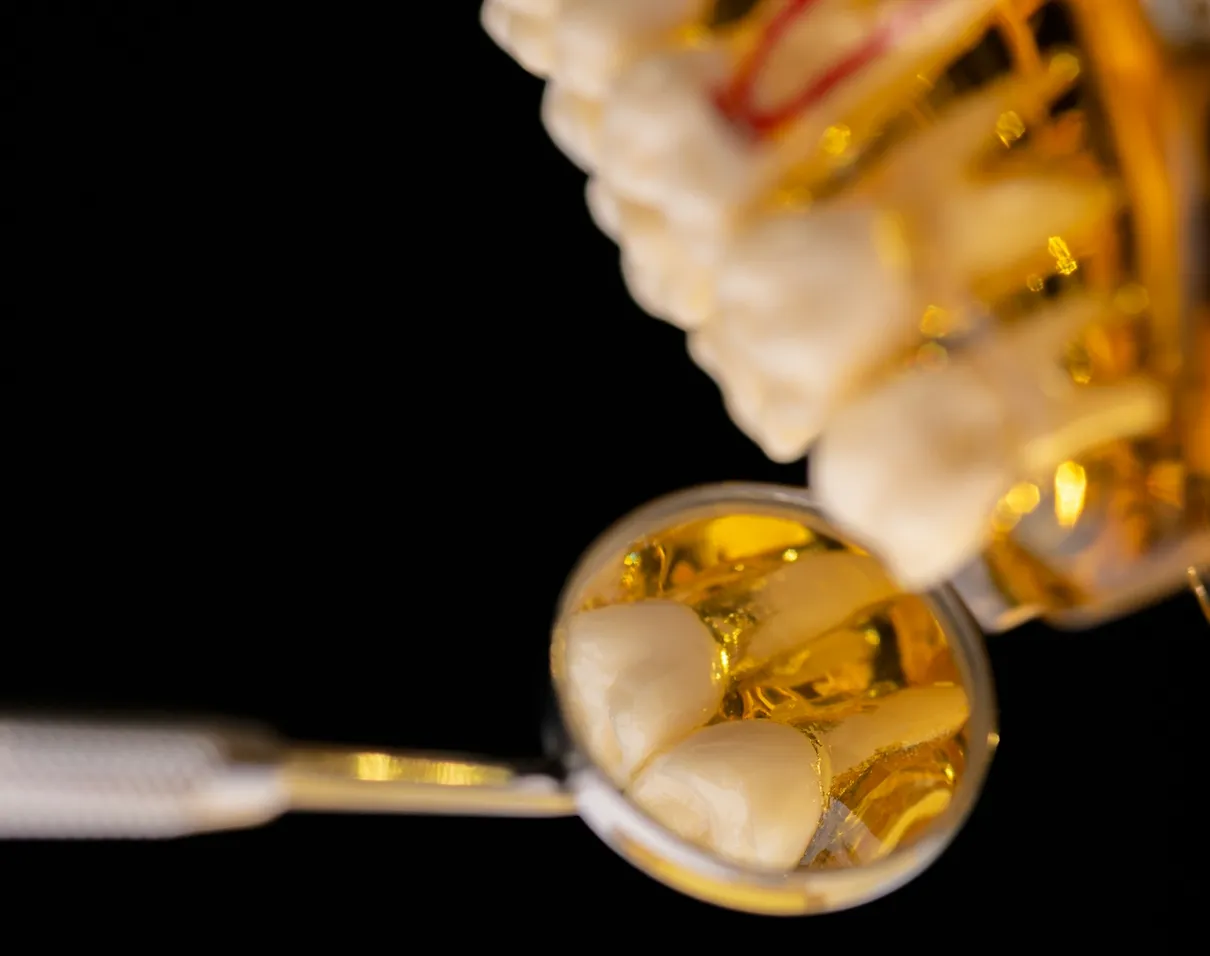 Dental mirror reflecting molars on a translucent dental model, close-up