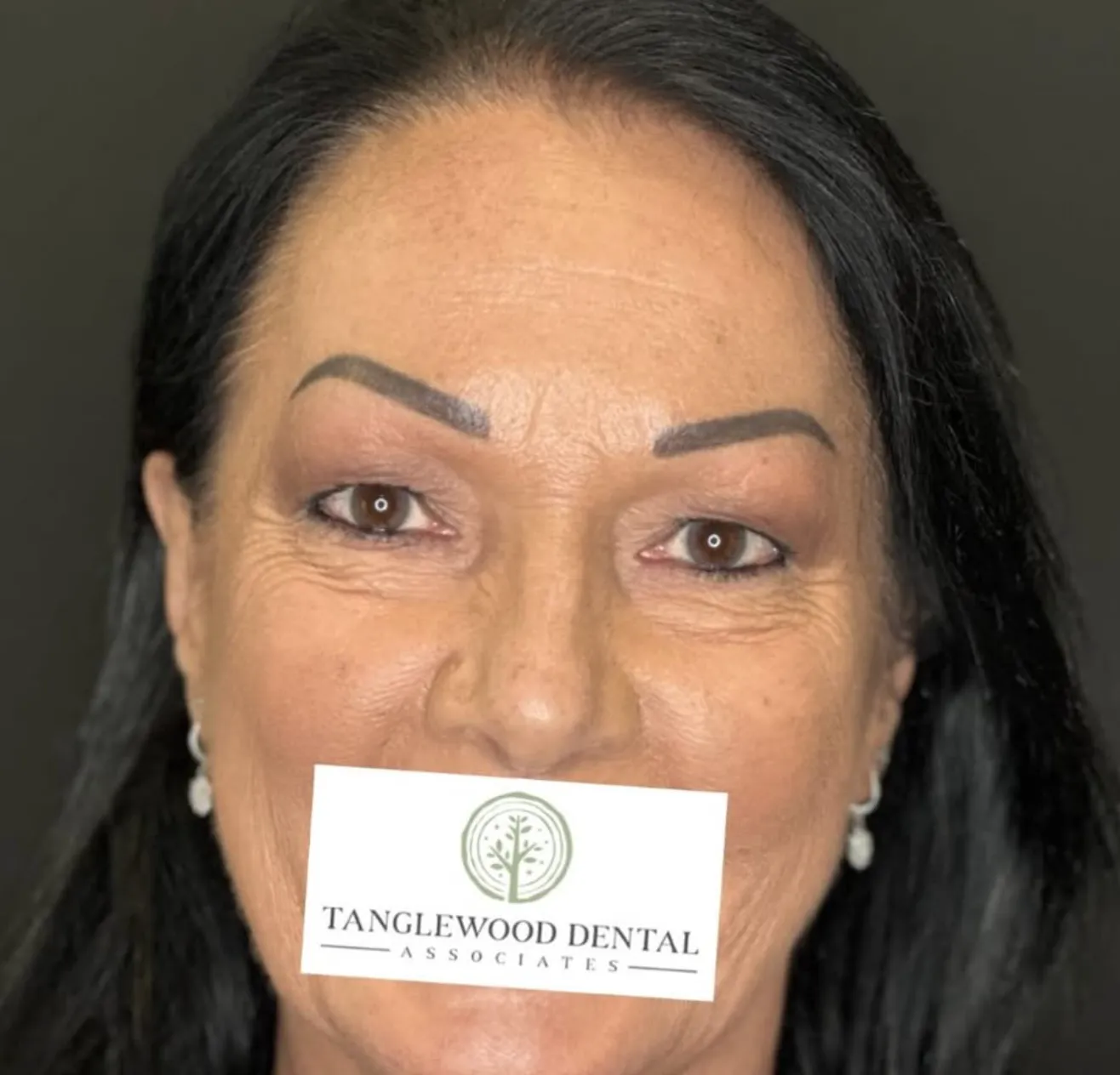 Patient holding a Tanglewood Dental Associates card over her mouth before her smile reveal