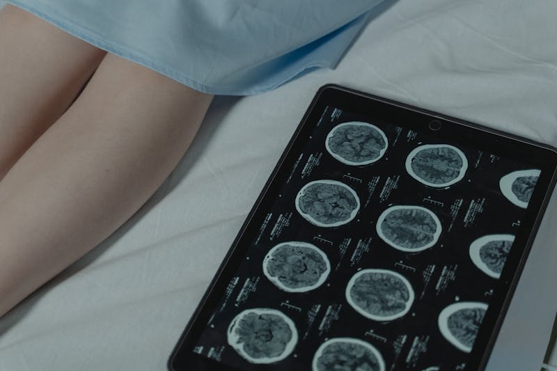 Résultats de scanner CT affichés sur une tablette numérique, montrant les coupes cérébrales obtenues lors d'un examen avec injection de produit de contraste