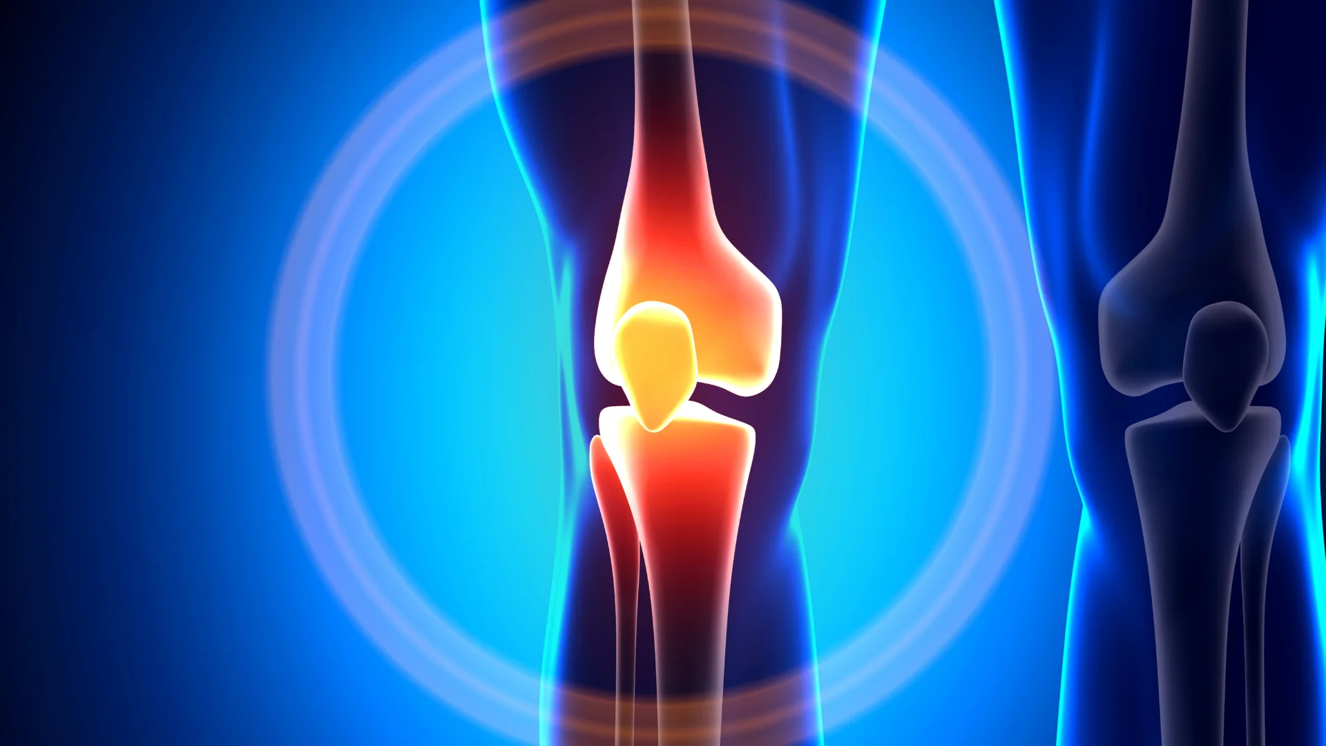 Болять суглоби? Перевір!